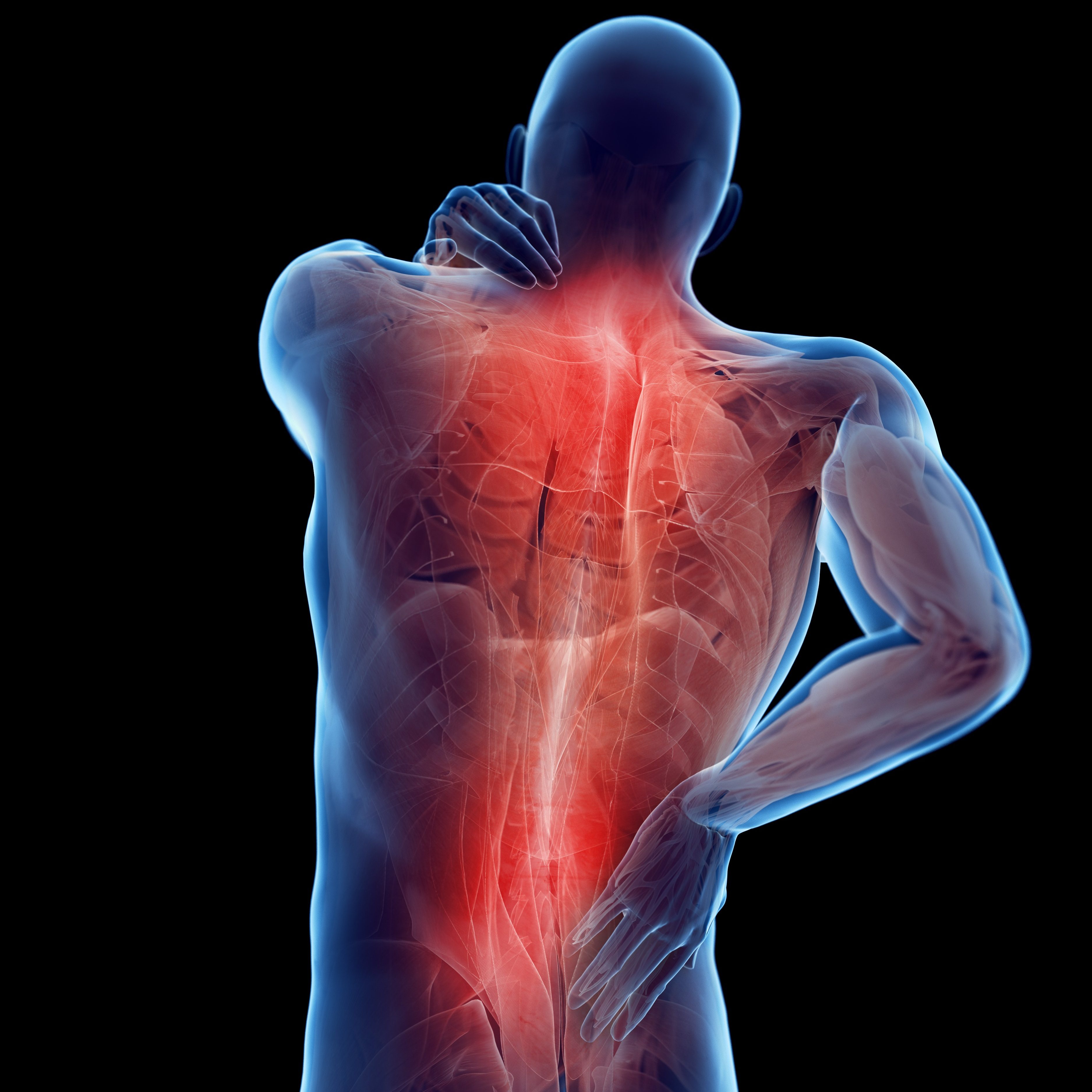 Back Pain, Conceptual Illustration